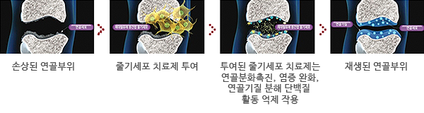 줄기세포 치료과정 - 일러스트