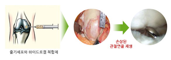 면역억제 및 조절능력 - 일러스트